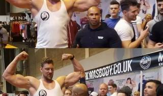 先天性漏斗胸 先天性漏斗胸